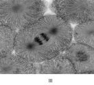 <strong> Which of thfollowing statements is CORRECT?</strong> A)After separation, the chromatids are called chromosomes. B)Old patches of the old nuclear envelope are used to build the two daughter nuclei. C)During anaphase, microtubules shorten. D)Telophase is essentially a reversal of the events of prophase. E)All of these are correct.