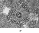 <strong> Which of thfollowing statements is CORRECT?</strong> A)After separation, the chromatids are called chromosomes. B)Old patches of the old nuclear envelope are used to build the two daughter nuclei. C)During anaphase, microtubules shorten. D)Telophase is essentially a reversal of the events of prophase. E)All of these are correct.