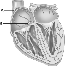 <strong> In this diagraof thheart, which of thfollowing choices correctly identifies A anB?</strong> A)A is the AV node; B is the cardiac pacemaker. B)A is the SA node; B is the septum. C)A is the AV node; B is the SA node. D)A is the SA node; B is the AV node. E)A is the septum; B is the cardiac pacemaker.