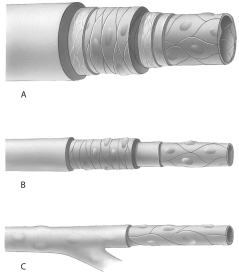 <strong> Use the above figure to answer questions What typof bloovessel is identifieas C?</strong> A)artery B)arteriole C)vein D)venule E)capillary