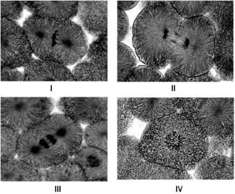 <strong> Examine the micrographs above and answer the following question(s). The cell in micrograph II is at which stage of the cell cycle?</strong> A) prophase B) telophase C) interphase D) anaphase E) metaphase