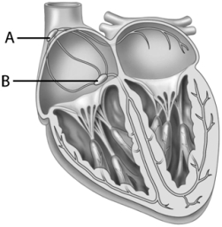 <strong>In this diagram of the heart,which of the following choices correctly identifies A and B?  </strong> A) A is the AV node; B is the cardiac pacemaker. B) A is the SA node; B is the septum. C) A is the AV node; B is the SA node. D) A is the SA node; B is the AV node. E) A is the septum; B is the cardiac pacemaker. <div style=padding-top: 35px> 