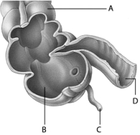 <strong>  Use the above picture to answer the following question(s). Referring to the above diagram,what structure is labeled C?</strong> A) the appendix B) the cecum C) a polyp D) a portion of the small intestine E) the colon <div style=padding-top: 35px> 