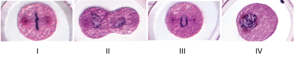 <strong>Examine the micrographs below to answer the following question. The cell in micrograph II is at which stage of the cell cycle?</strong> A)prophase B)telophase C)interphase D)anaphase E)metaphase