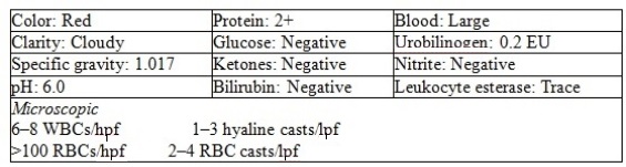 <strong>Following recovery from an upper respiratory infection,a 5-year-old boy develops numerous petechiae.He reports that his urine is red.Results of his urinalysis are: Based on the information provided,how does the presence of petechiae relate to the abnormal results?</strong> A) Allergic reaction B) Decreased vascular integrity C) Increased platelets D) Increased destruction of red cells