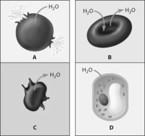 Which figure depicts an animal cell placed in a solution hypotonic to the cell?