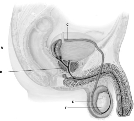 -Which structure may swell and cause increased frequency of urination due to common medical problems in older men?