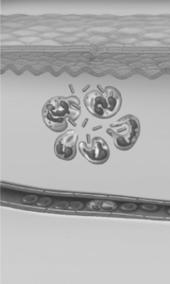 <strong>What event could have led to the situation shown in the accompanying figure? </strong> A) A person inhaled some pollen. B) A person encountered the flu virus. C) A person was bitten by a spider. D) A person suffered a heart attack.