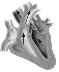 Which of the following describes the stage of the cardiac cycle shown?