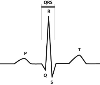 <strong>After reading the paragraphs below, answer the questions that follow. Electrocardiographs (ECGs or EKGs) provide data about the electrical activity of the heart. By placing a series of leads on a person's chest, the electrical activity of the heart can be recorded and analyzed in order to detect irregular heartbeats (arrhythmias) and other conditions. The figure below shows a normal EKG tracing for one cardiac cycle. The P region represents electrical activity spreading through the atria. The QRS region represents electrical activity spreading through the ventricles. The T region represents electrical activity in the ventricles returning to rest. What is happening in the heart during the QRS region?</strong> A) The atria are filling with blood. B) The ventricles are filling with blood. C) The atria are contracting. D) The ventricles are contracting.
