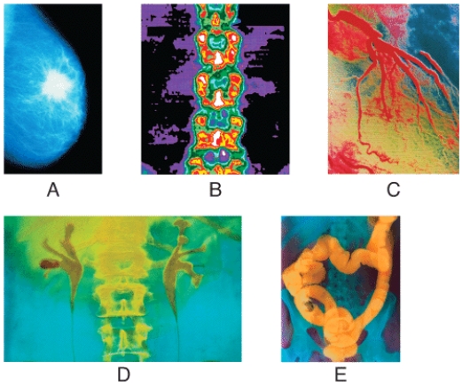 Which radiographs were obtained using a contrast material and x-rays?