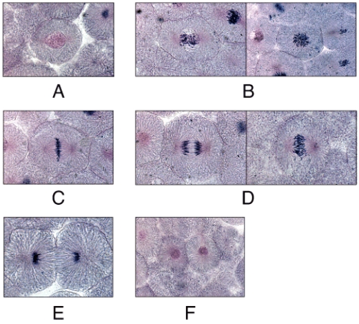 <strong>In the diagram,which panel shows the kinetochore of the centromeres aligning along the center of the mitotic spindle of the cell? </strong> A)A B)B C)C D)D E)E