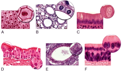<strong>Which of the light micrographs in the figure below shows a simple columnar epithelium? </strong> A)A B)B C)C D)D E)E