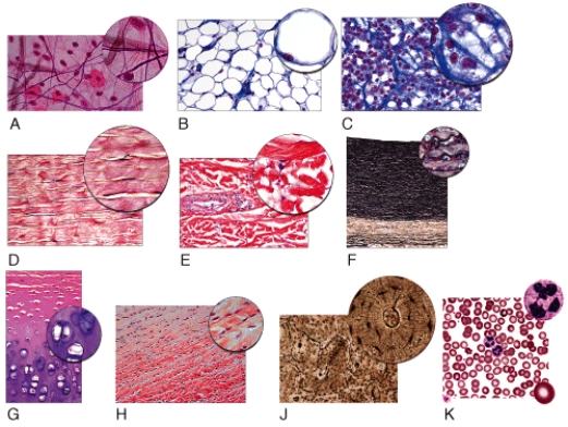 <strong>In the figure shown,which light micrograph shows the type of connective tissue that contains the Hardest matrix of all connective tissues? </strong> A)K B)J C)G D)B E)D