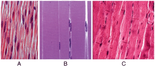 <strong>In the figure shown,which light micrograph shows a muscle tissue that is under involuntary control????1 A?2 B?3 C </strong> A)1 only B)2 only C)3 only D)1 and 2 E)1 and 3