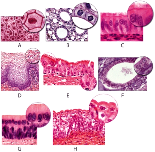 <strong>Which of the following figures shows tissue whose functions are secretion and absorption? </strong> A)B B)C C)D D)G E)H