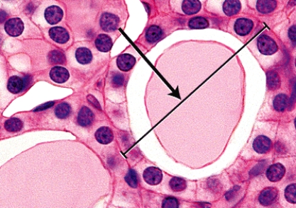 <strong>Which substance is secreted by the gland shown? </strong> A)sweat B)oil C)hormones D)saliva E)earwax