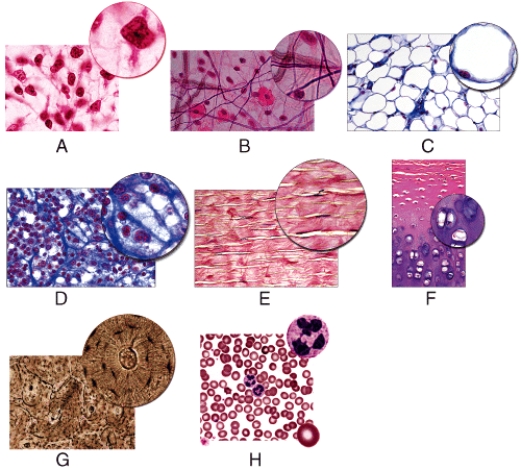 <strong>Which of the following figures shows tissue found in yellow bone marrow? </strong> A)A B)B C)C D)D E)H
