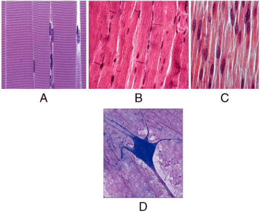 <strong>Which is a function of the tissue shown in diagram A? </strong> A)heat production B)pumping of blood C)propulsion of food D)contraction of bladder E)conduct nerve impulses to muscle fibers