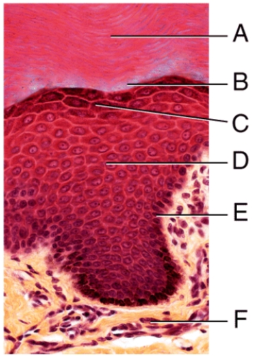 <strong>In the photomicrograph of a portion of thick skin shown below,which layer is only seen in thick skin? </strong> A)A B)B C)C D)D E)E