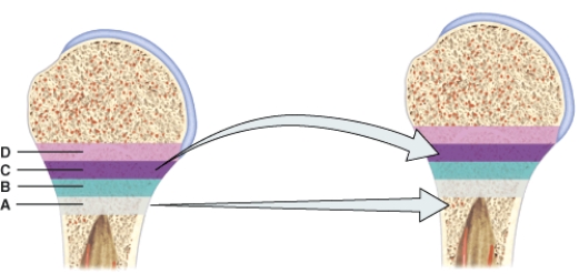 <strong>In the diagram,this zone contains mostly dead chondrocytes surrounded by a calcified matrix. </strong> A)A B)B C)C D)D