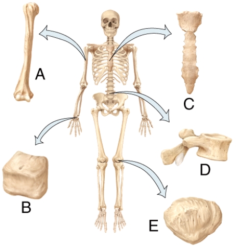 <strong>In the diagram,which bone is the short bone? </strong> A)A B)B C)C D)D E)E