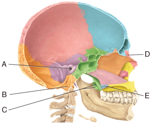 <strong>In the diagram,where is the pterygoid process? </strong> A)A B)B C)C D)D E)E