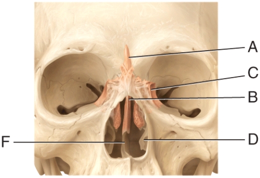 <strong>In the diagram,where is the vomer bone? </strong> A)A B)B C)F D)D E)E