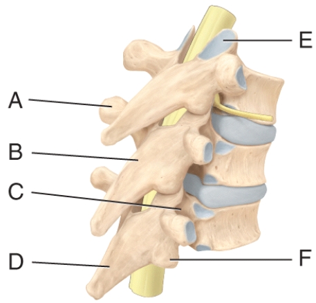 Where is the inferior articular process in the diagram?  