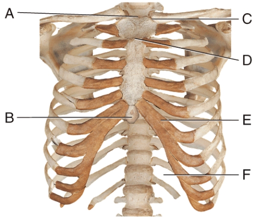 In the diagram,which part is often broken during CPR due to incorrect positioning of hands?
