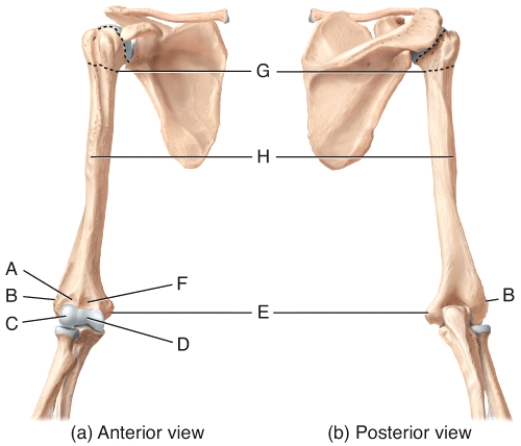 <strong>In the diagram of the humerus,where is the anatomical neck? </strong> A)D B)E C)F D)G E)Not labeled in diagram