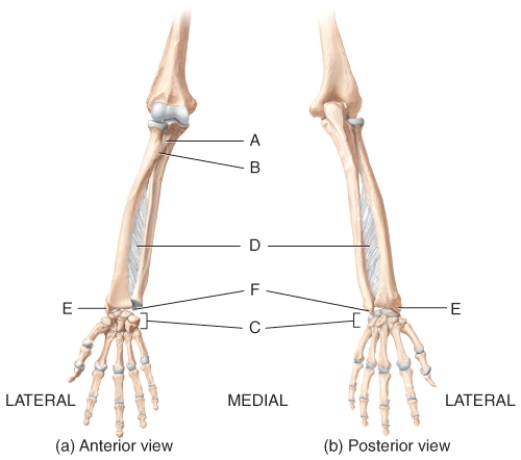 <strong>In the diagram of the ulna and radius,where is the radial tuberosity? </strong> A)A B)B C)E D)F E)None of these choices are correct.