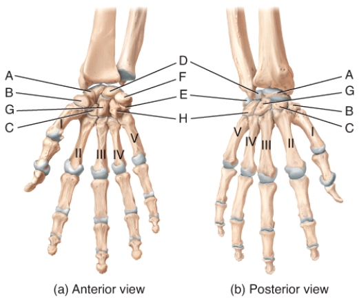 <strong>In the diagram of the hand and wrist,where is the scaphoid bone? </strong> A)A B)B C)C D)E E)G