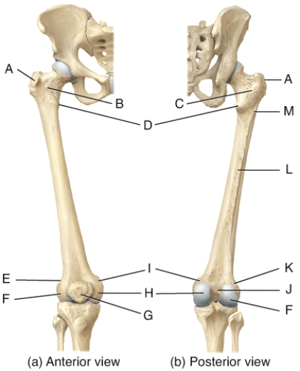 In the diagram of the femur,where is the medial condyle?  