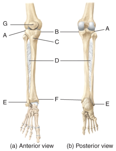 In the diagram of the tibia and fibula,what articulates with the condyles of the femur to form the tibiofemoral joint?