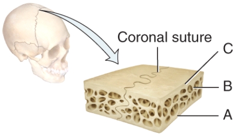 <strong>In the below diagram of a suture joint,where is the spongy bone?  </strong> A)A B)B C)C D)Both A and C E)Both A and B <div style=padding-top: 35px> 