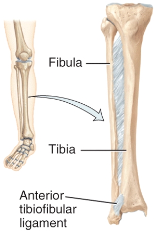 <strong>What type of joint is shown in the diagram?  </strong> A)Suture B)Syndesmosis C)Symphysis D)Cartilaginous E)Synovial <div style=padding-top: 35px> 