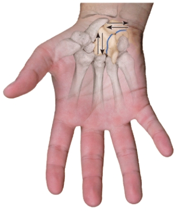 <strong>Which type of joint permits this type of movement???1.Synovial joint?2.Cartilaginous joint?3.Fibrous joint  </strong> A)1 only B)2 only C)3 only D)Both 1 &2 E)Both 2 & 3 <div style=padding-top: 35px> 