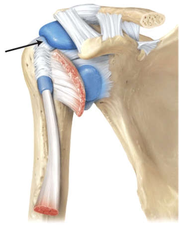 The line is pointing to the _______ ligament.  