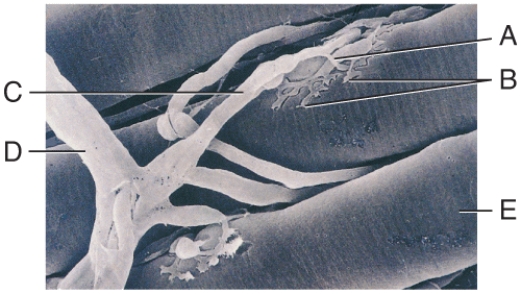 <strong>In the diagram,where is the axon terminal? </strong> A)A B)B C)C D)D E)E