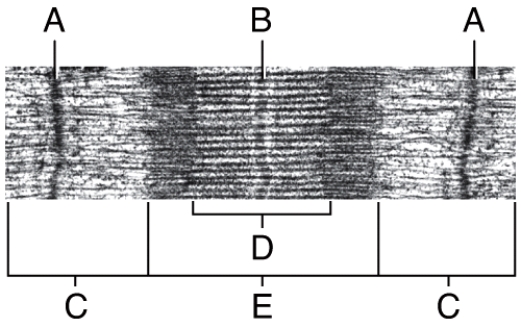 <strong>In the diagram,locate the region where only myosin proteins are found. </strong> A)A B)B C)D D)E E)None of these is correct.