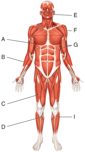 <strong>Where are the thenar muscles?  </strong> A)D B)E C)G D)H E)None of these answers are correct. <div style=padding-top: 35px> 