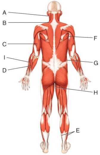<strong>Where is the external oblique?  </strong> A)D B)G C)H D)I E)E <div style=padding-top: 35px> 