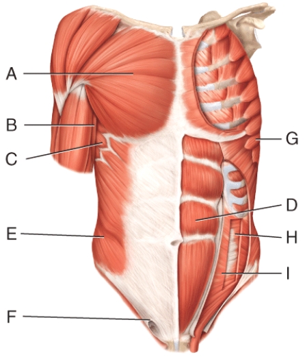 <strong>Where is the serratus anterior?  </strong> A)A B)B C)C D)D E)G <div style=padding-top: 35px> 