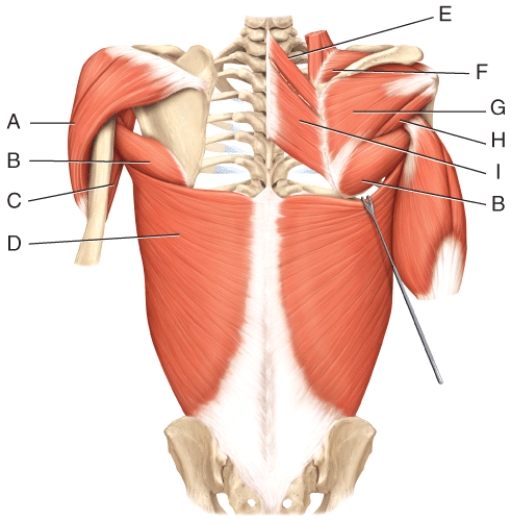 <strong>Where is the lastissimus dorsi?  </strong> A)A B)B C)C D)D E)I <div style=padding-top: 35px> 