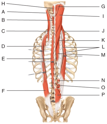 <strong>Where is the splenius capitis?  </strong> A)A B)B C)C D)H E)I <div style=padding-top: 35px> 