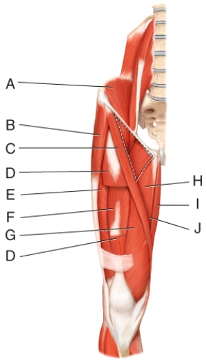 <strong>Where is the iliacus?  </strong> A)A B)B C)C D)H E)None of these choices <div style=padding-top: 35px> 