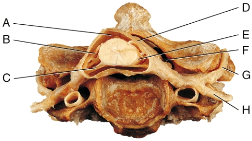 <strong>Which of the labeled structures carries exclusively sensory information towards the spinal cord? </strong> A)B B)C C)F D)G E)H
