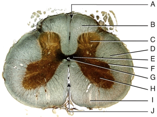 <strong>Where is the anterior gray horn? </strong> A)B B)C C)H D)I E)None of these choices