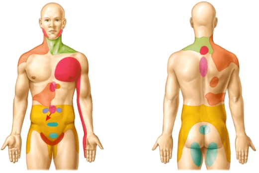 What do colored regions on body's surface in the diagram represent?